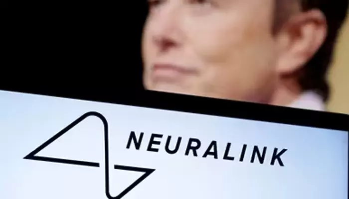 Neuralink's First Patient Controls Computer By Thinking: The Technology Behind Brain Chip