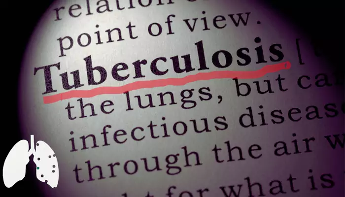 World TB Day – Signs And Symptoms To Watch Out For